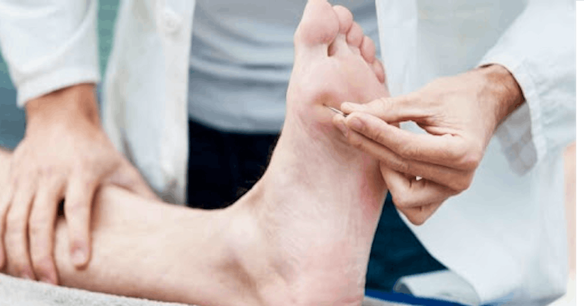 feet neuropathy