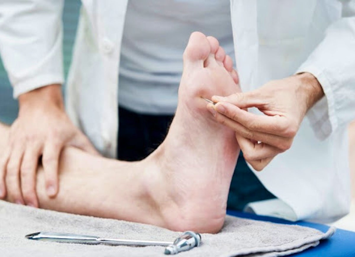 feet neuropathy