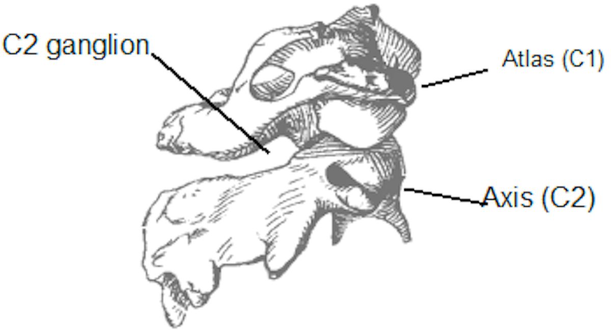 Anatomical diagram of C2 Ganglion, Atlas (C1), and Axis (C2)