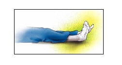 Ankle Pumps exercise