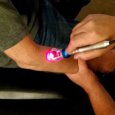  laser therapy elbow