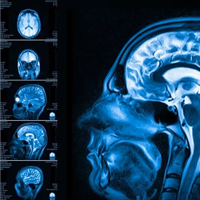 MRI of human brain