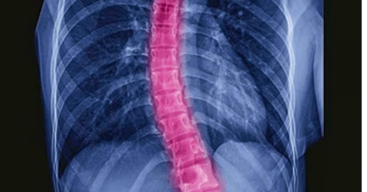 redspine
