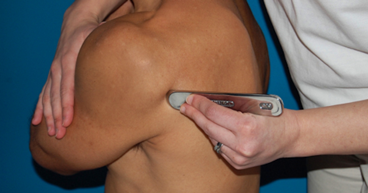 Graston Technique Muscle and Scar Tissue Treatment | White Plains