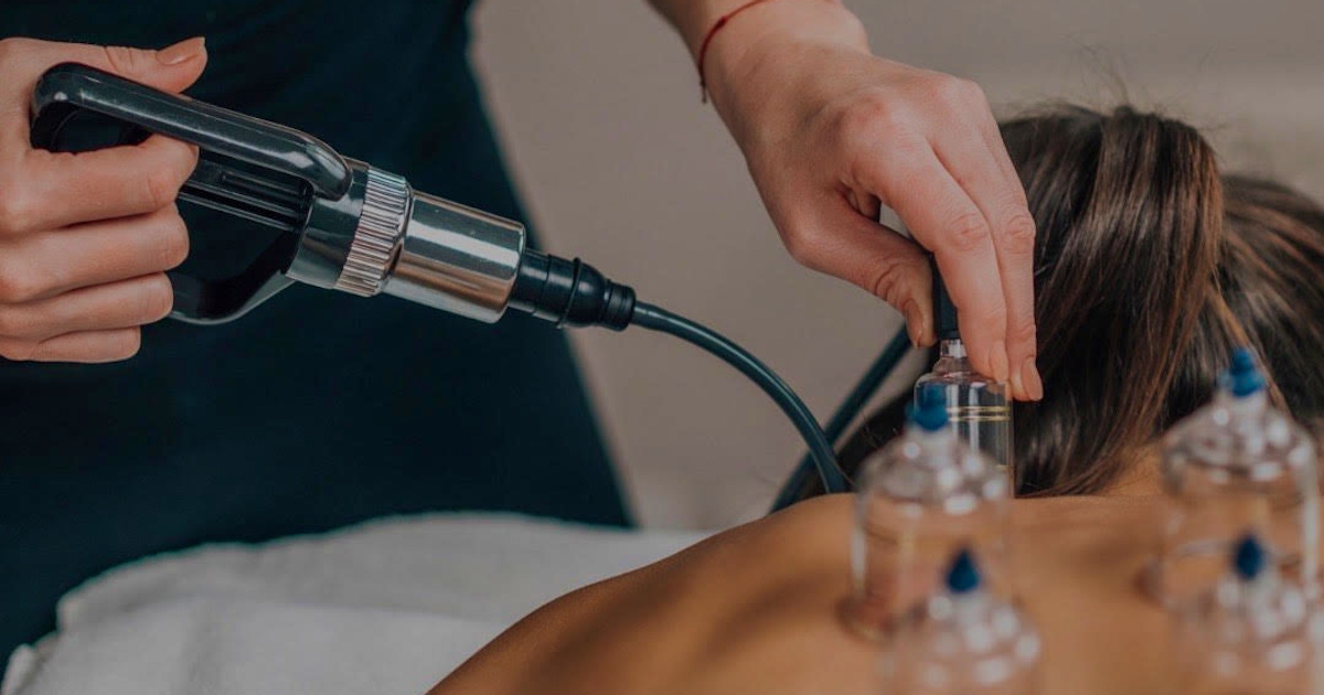 cupping