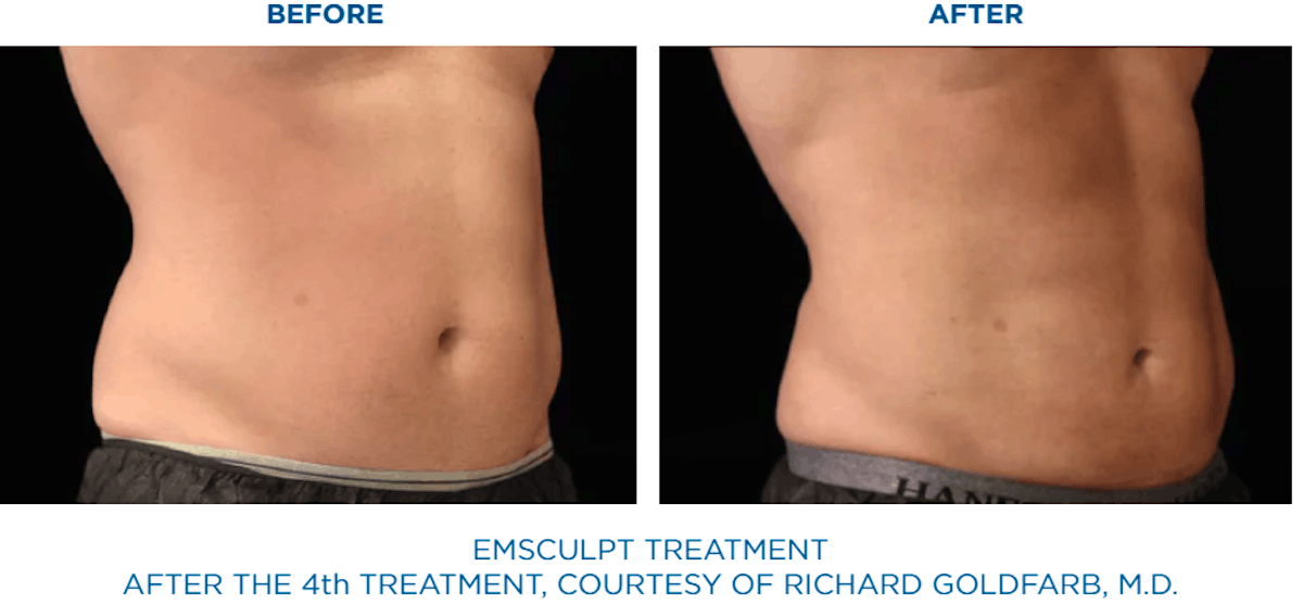 shape and contour body