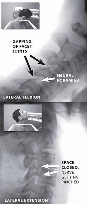 x-ray