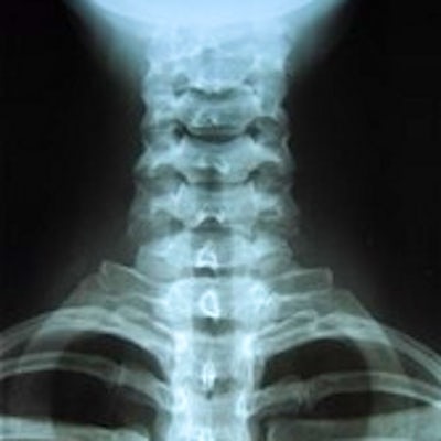 xray_